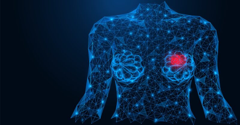 Inflammation of the breast in women. Female breasts with signs of the disease. A low-poly construction of interconnected lines and points. Blue background.