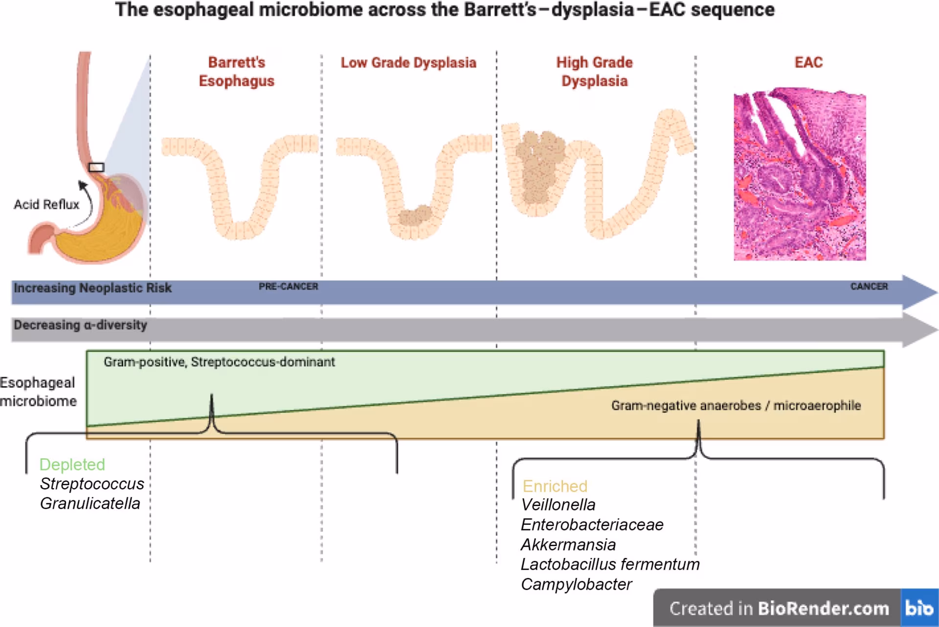 Figure 2: Impact of microbiome on esophageal dysplasia